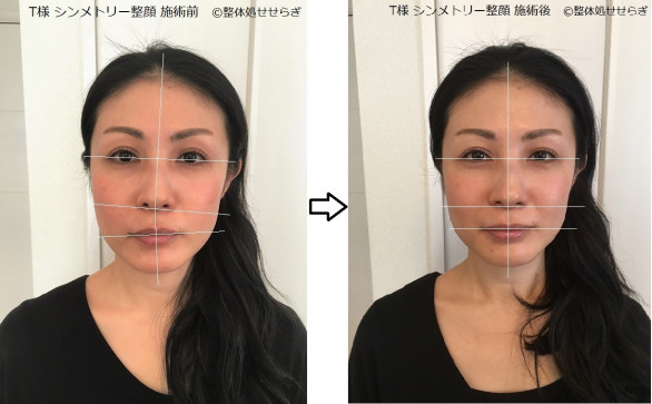 シンメトリー整顔について 横浜白楽 整体処せせらぎ