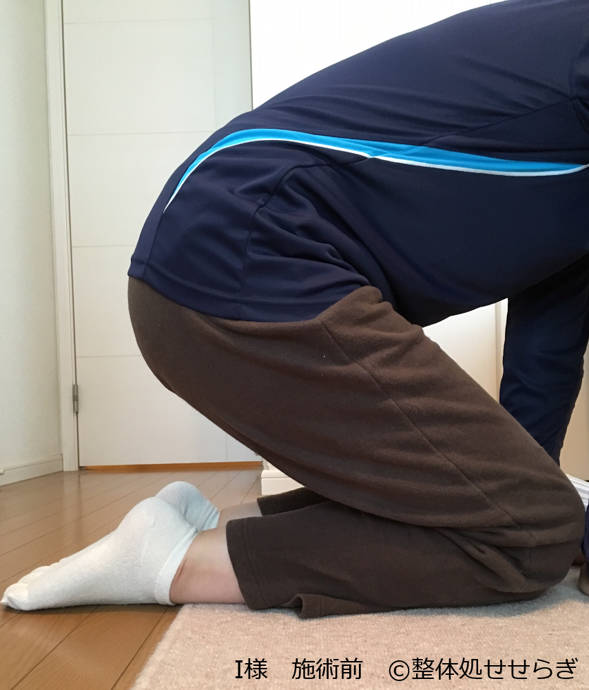 前十字靭帯断裂と半月板損傷の手術後 変形性膝関節症で膝が曲がらず正座ができない 横浜白楽 整体処せせらぎ 前十字靭帯断裂と半月板損傷の手術後 変形性膝関節症で膝が曲がらず正座ができない 横浜白楽 整体処せせらぎ