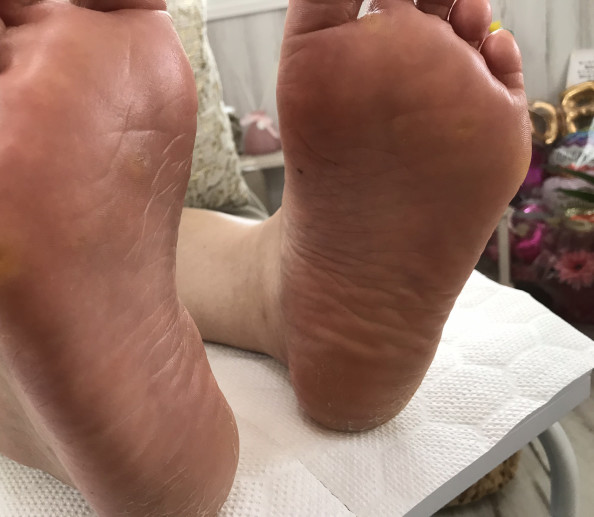 足裏ガサガサかちこちになってない 手足のケアサロン ラ ミシェリ 秋田 藤里町 能代市