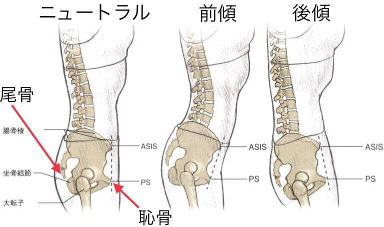 骨盤の前傾 後傾と筋肉の関係 Luccica 骨盤の前傾 後傾と筋肉の関係 Luccica