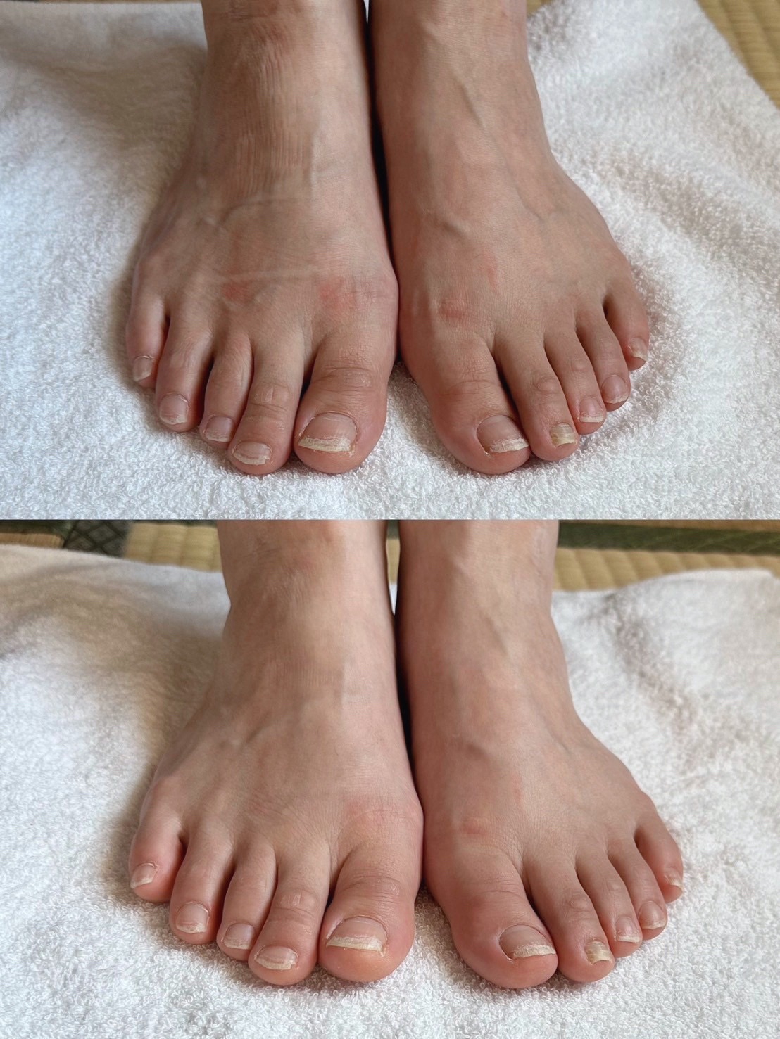 トウリーディングについて | salon SHEER.